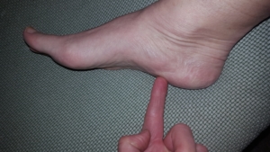 Photograph of finger pointing site of heel pain